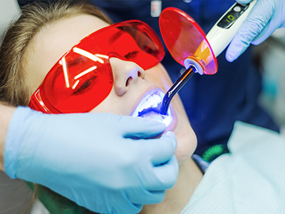 Laser Dentistry