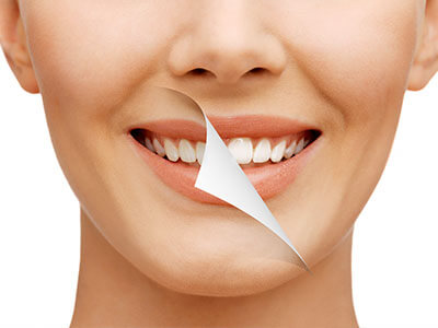 KoR Whitening